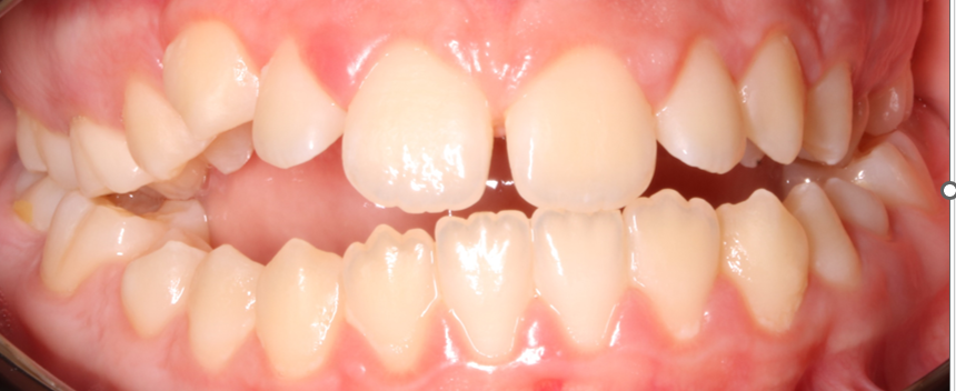 FRONTAL INICIAL